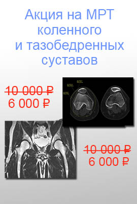 Акция МРТ колена и ТБС